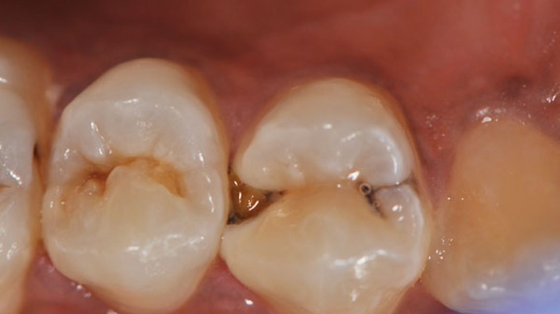 Dentalia smiles